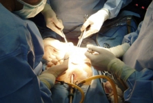 Kist Ameliyatı Sonrası